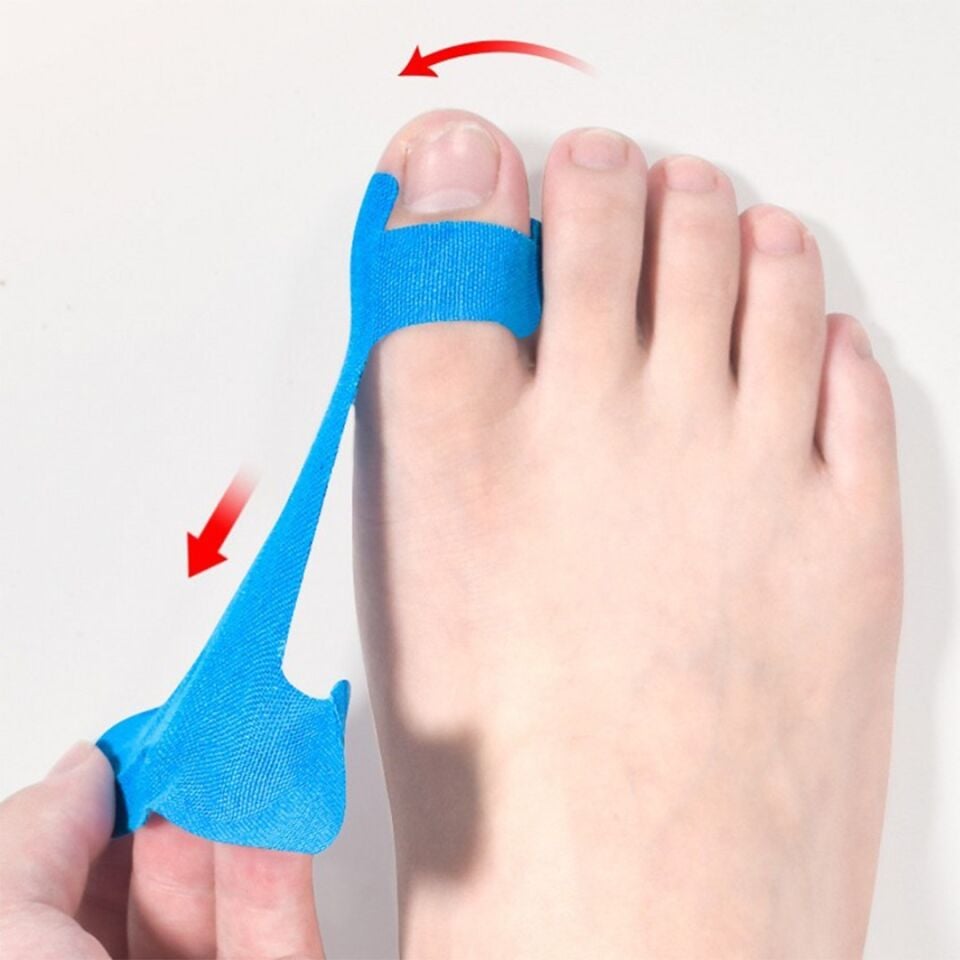 Sunup SN-39281 Halluks Valgus Düzeltici Kinesiyoloji Bandı 20 Adet Ayak Parmak Düzeltici Bant