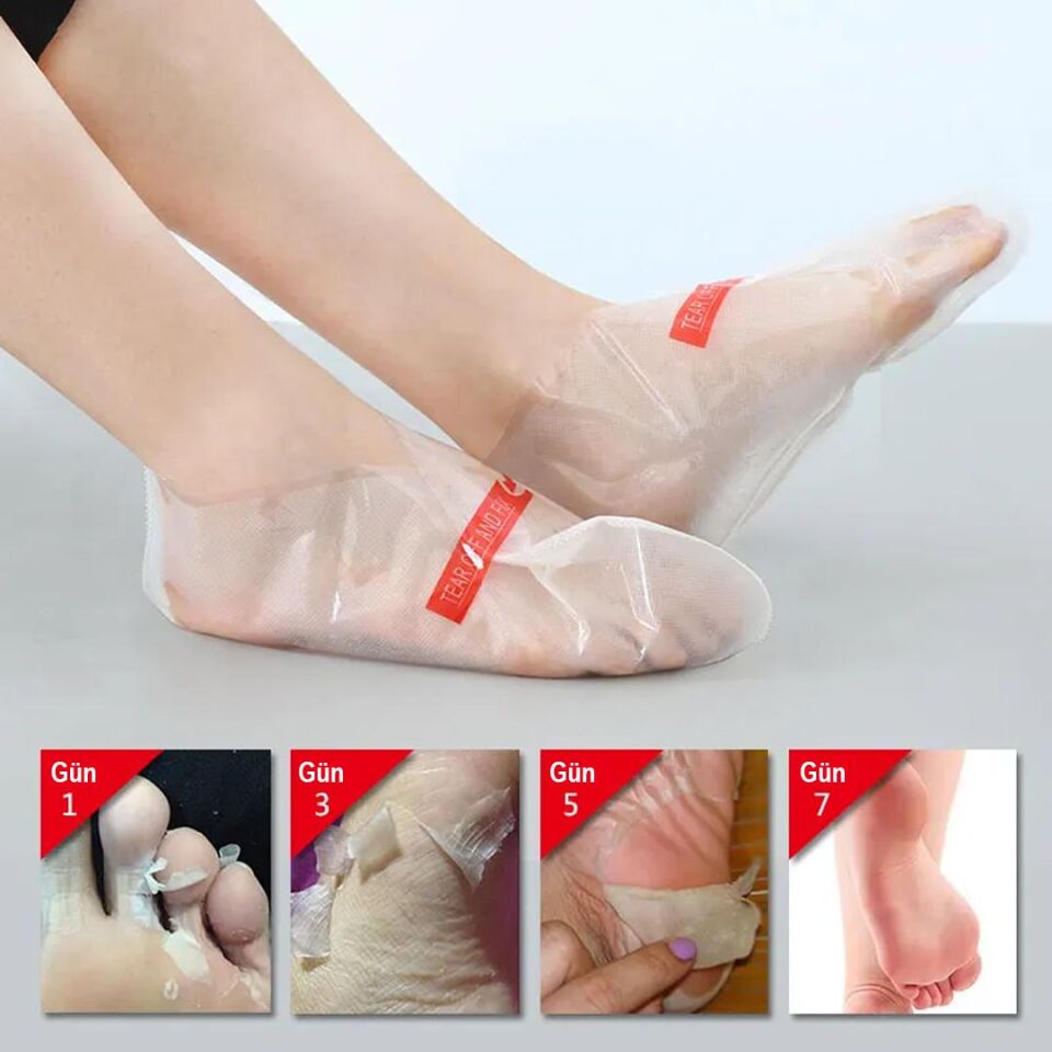 Ayt Sunup SN-26965 Ayak Peeling Maskesi Nasır Ö lü Deri Egzama Giderici 1 Çift Ayak Nemlendirici Özellikli